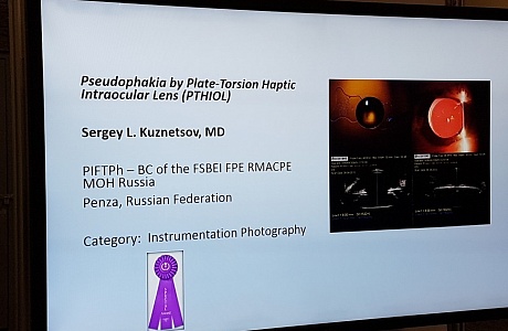 Globally recognised ophthalmic technologies available to Penza citizens